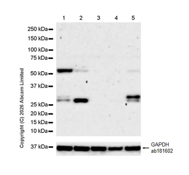Western blot - Anti-Gremlin 1 antibody [EPR29485-567] (AB326998)