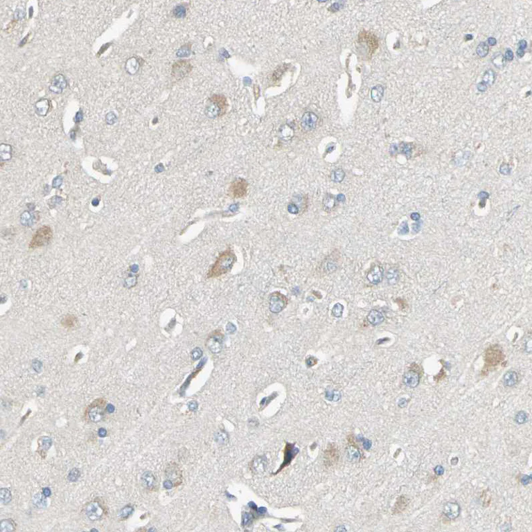 Immunohistochemistry (Formalin/PFA-fixed paraffin-embedded sections) - Anti-GRF2 antibody (AB251683)