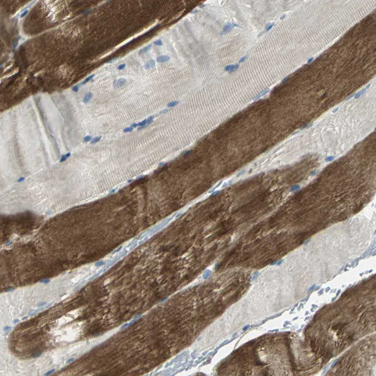 Immunohistochemistry (Formalin/PFA-fixed paraffin-embedded sections) - Anti-GRF2 antibody (AB251683)
