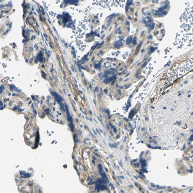 Immunohistochemistry (Formalin/PFA-fixed paraffin-embedded sections) - Anti-GRF2 antibody (AB251683)