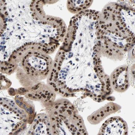 Immunohistochemistry (Formalin/PFA-fixed paraffin-embedded sections) - Anti-GRHL2 antibody (AB211360)