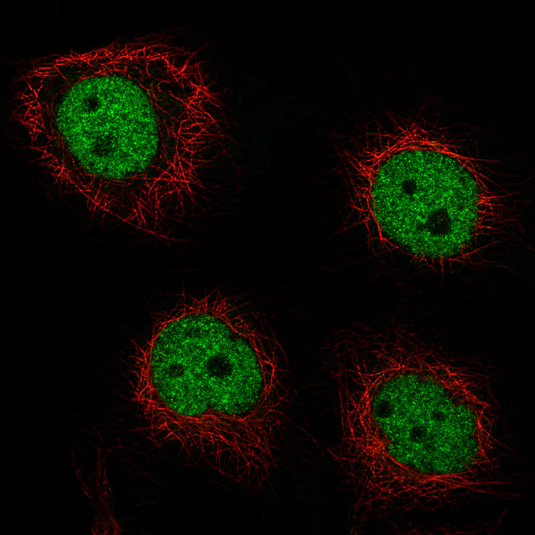 Immunocytochemistry - Anti-GRHL2 antibody [CL3760] (AB236758)