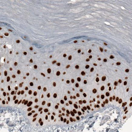 Immunohistochemistry (Formalin/PFA-fixed paraffin-embedded sections) - Anti-GRHL2 antibody [CL3760] (AB236758)