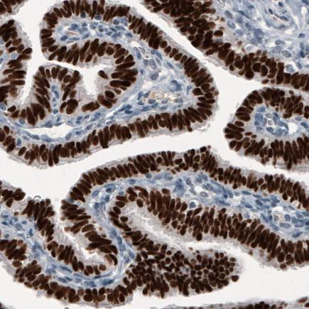 Immunohistochemistry (Formalin/PFA-fixed paraffin-embedded sections) - Anti-GRHL2 antibody [CL3760] (AB236758)
