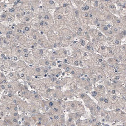 Immunohistochemistry (Formalin/PFA-fixed paraffin-embedded sections) - Anti-GRHL2 antibody [CL3760] (AB236758)