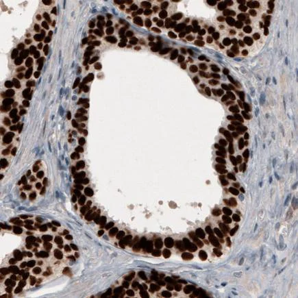 Immunohistochemistry (Formalin/PFA-fixed paraffin-embedded sections) - Anti-GRHL2 antibody [CL3760] (AB236758)