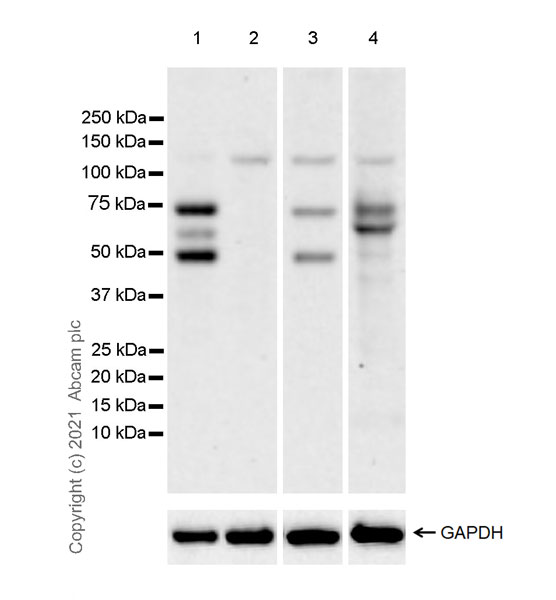 Western blot - Anti-GRHL2 antibody [EPR24386-76] (AB271023), expandable thumbnail