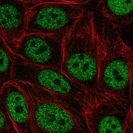 Immunocytochemistry/ Immunofluorescence - Anti-GRHL3 antibody (AB221058)