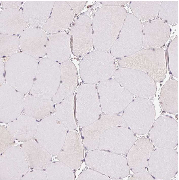 Immunohistochemistry (Formalin/PFA-fixed paraffin-embedded sections) - Anti-GRHL3 antibody (AB221058)