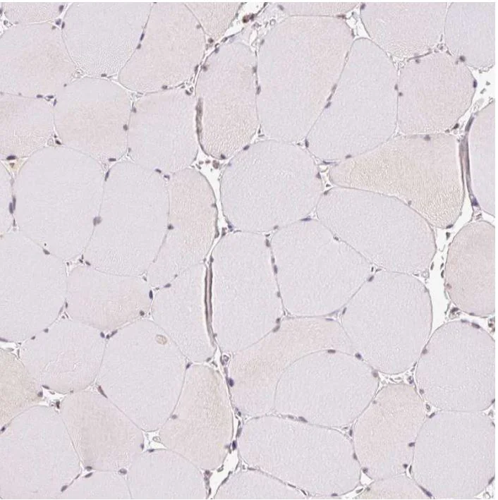 Immunohistochemistry (Formalin/PFA-fixed paraffin-embedded sections) - Anti-GRHL3 antibody (AB221058)