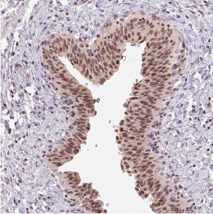 Immunohistochemistry (Formalin/PFA-fixed paraffin-embedded sections) - Anti-GRHL3 antibody (AB221058)