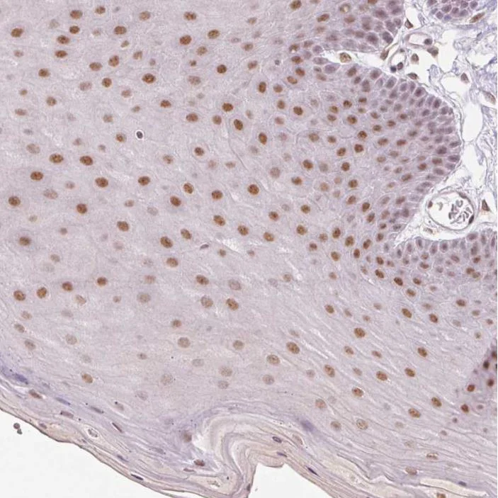 Immunohistochemistry (Formalin/PFA-fixed paraffin-embedded sections) - Anti-GRHL3 antibody (AB221058)