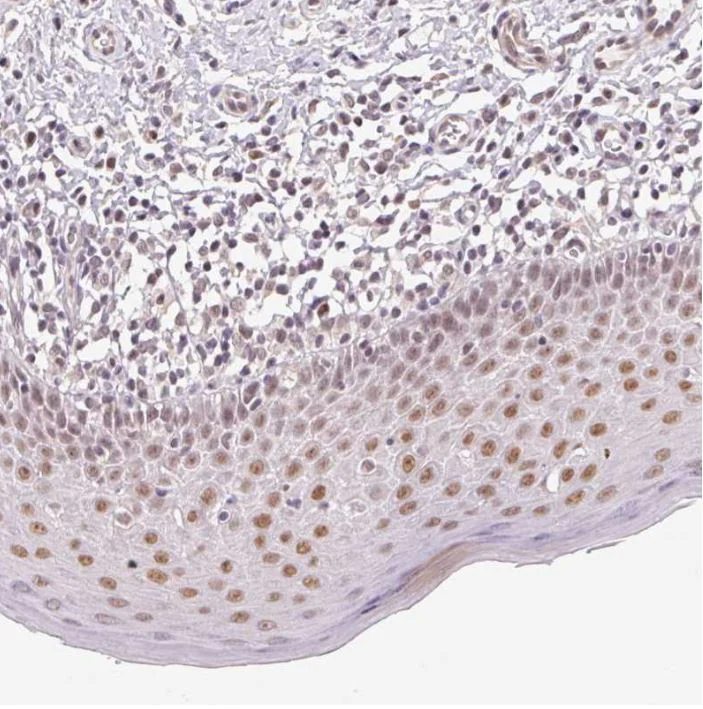 Immunohistochemistry (Formalin/PFA-fixed paraffin-embedded sections) - Anti-GRHL3 antibody (AB221058)