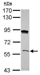 Western blot - Anti-GRHL3 antibody (AB228921), expandable thumbnail