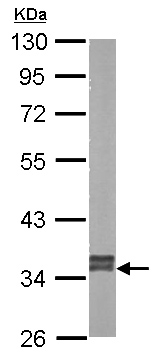 Western blot - Anti-GRHPR antibody (AB155604)