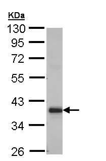 Western blot - Anti-GRHPR antibody (AB155604)