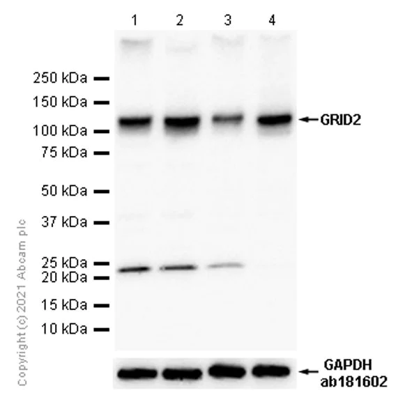 Western blot - Anti-GRID2 antibody [EPR15422] - BSA and Azide free (AB251255)