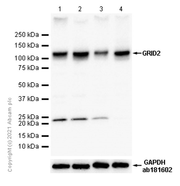 Western blot - Anti-GRID2 antibody [EPR15422] - N-terminal (AB198499), expandable thumbnail