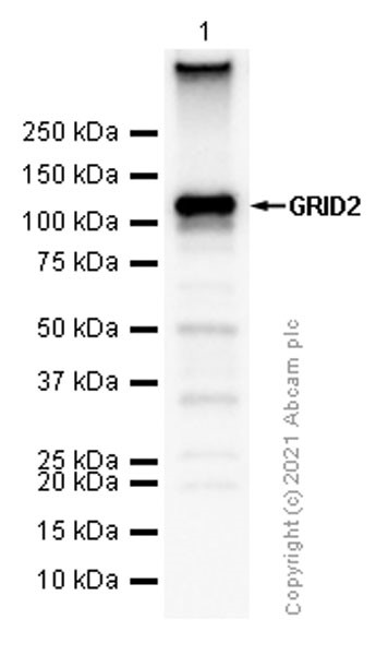 Western blot - Anti-GRID2 antibody [EPR15422] - N-terminal (AB198499), expandable thumbnail