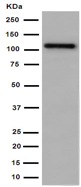 Western blot - Anti-GRID2 antibody [EPR15423(B)] (AB190358)