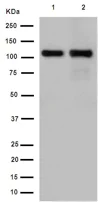 Western blot - Anti-GRID2 antibody [EPR15423(B)] (AB190358)