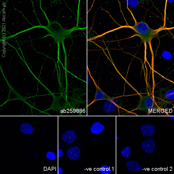 Immunocytochemistry/ Immunofluorescence - Anti-GRIK1+GRIK2 antibody [EPR23995-85] (AB259886)