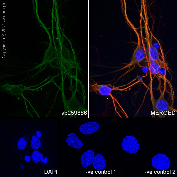 Immunocytochemistry/ Immunofluorescence - Anti-GRIK1+GRIK2 antibody [EPR23995-85] (AB259886)