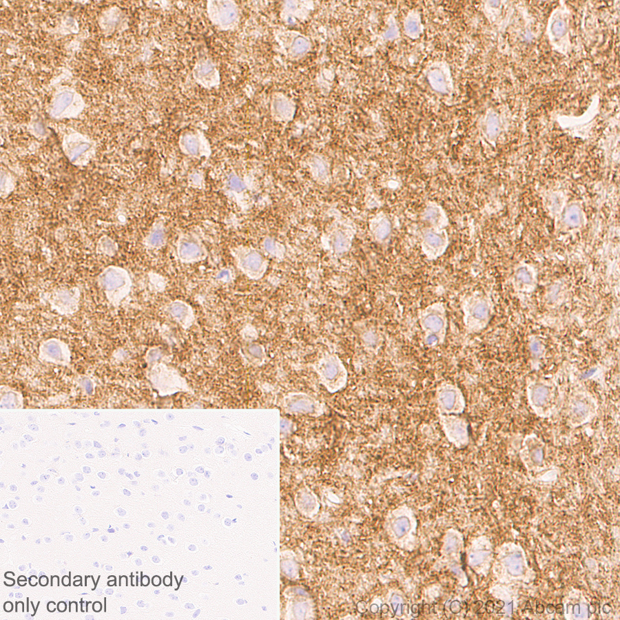 Immunohistochemistry (Formalin/PFA-fixed paraffin-embedded sections) - Anti-GRIK1+GRIK2 antibody [EPR23995-85] (AB259886), expandable thumbnail