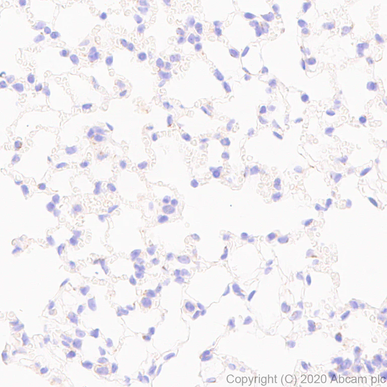 Immunohistochemistry (Formalin/PFA-fixed paraffin-embedded sections) - Anti-GRIK1+GRIK2 antibody [EPR23995-85] (AB259886)