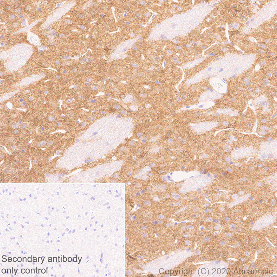 Immunohistochemistry (Formalin/PFA-fixed paraffin-embedded sections) - Anti-GRIK1+GRIK2 antibody [EPR23995-85] (ab259886), expandable thumbnail