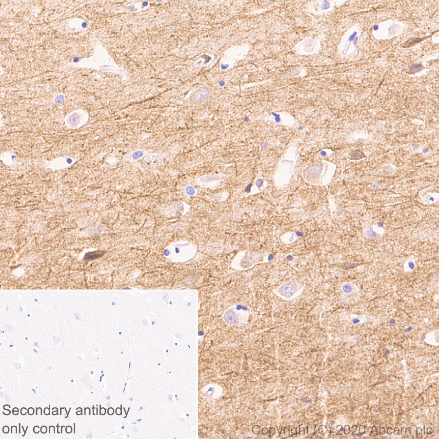 Immunohistochemistry (Formalin/PFA-fixed paraffin-embedded sections) - Anti-GRIK1+GRIK2 antibody [EPR23995-85] (ab259886), expandable thumbnail