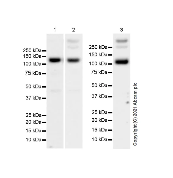 Western blot - Anti-GRIK1+GRIK2 antibody [EPR23995-85] (AB259886)
