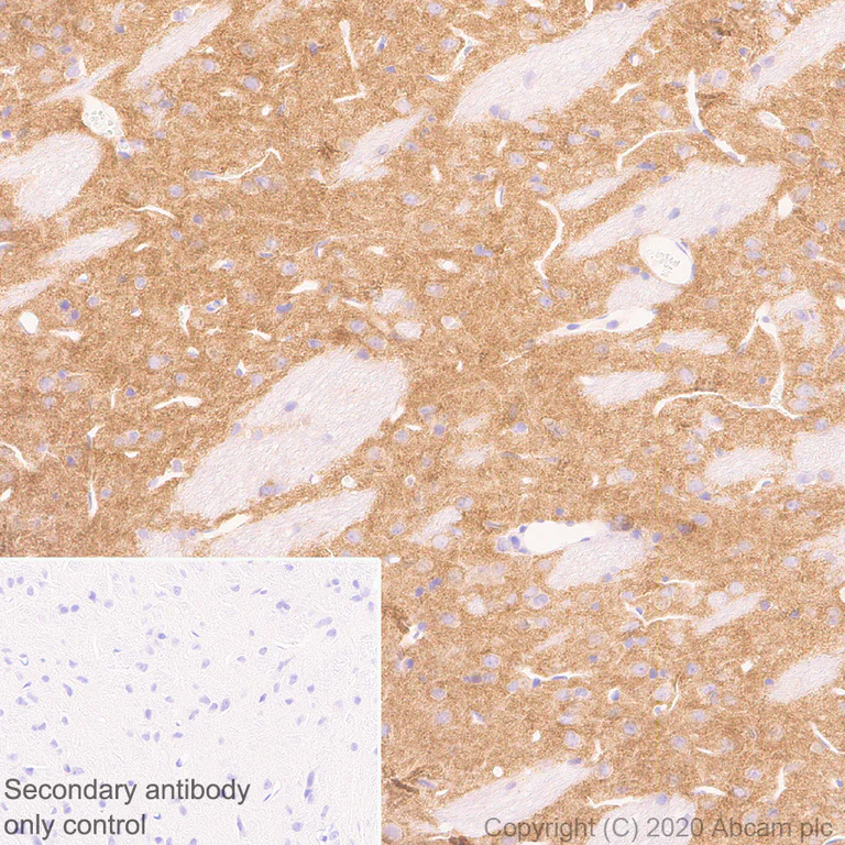 Immunohistochemistry (Formalin/PFA-fixed paraffin-embedded sections) - Anti-GRIK1+GRIK2 antibody [EPR23995-85] - BSA and Azide free (AB282286)