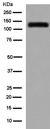 Western blot - Anti-GRIK2/GluK2 + GRIK3/GluK3 antibody [EPR13726] - BSA and Azide free (AB250648), expandable thumbnail