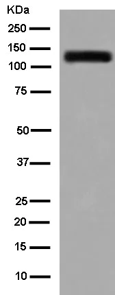 Western blot - Anti-GRIK2/GluK2 + GRIK3/GluK3 antibody [EPR13726] - BSA and Azide free (AB250648)