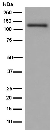 Western blot - Anti-GRIK2/GluK2 + GRIK3/GluK3 antibody [EPR13726] - BSA and Azide free (AB250648), expandable thumbnail