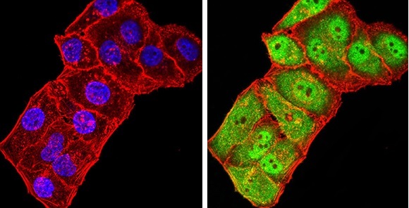 Immunocytochemistry/ Immunofluorescence - Anti-GRIK3/GluK3 antibody [2B3D1] (AB233734)