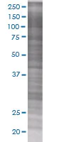 SDS-PAGE - GRIM19 overexpression 293T lysate (whole cell) (AB94271)