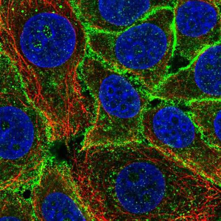 Immunocytochemistry/ Immunofluorescence - Anti-GRIN1 antibody (AB222150)