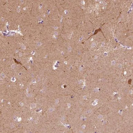 Immunohistochemistry (Formalin/PFA-fixed paraffin-embedded sections) - Anti-GRIN1 antibody (AB222150)