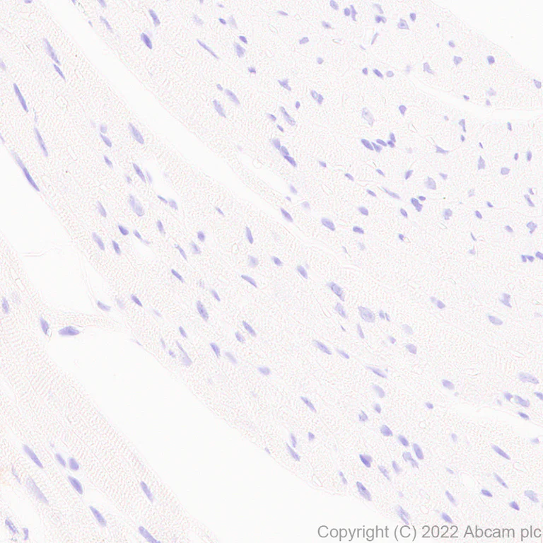 Immunohistochemistry - Anti-GRIN3A antibody [EPR25287-73] (AB305031)