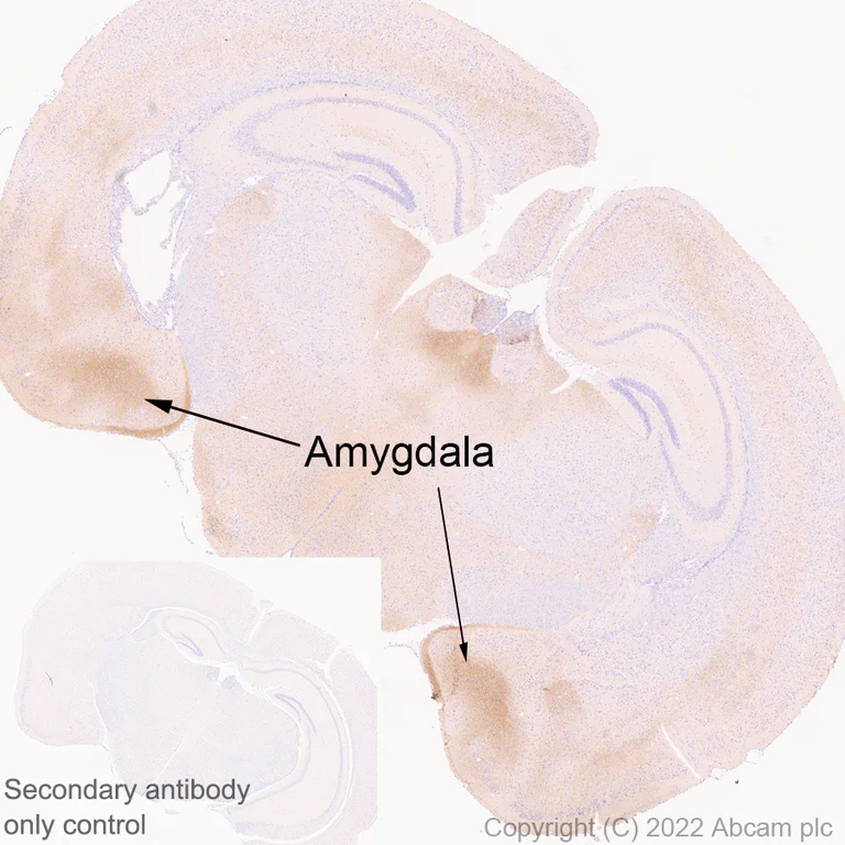 Immunohistochemistry - Anti-GRIN3A antibody [EPR25287-73] (AB305031)
