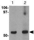 Western blot - Anti-GRINL1A antibody (AB113427)