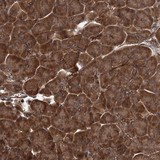Immunohistochemistry (Formalin/PFA-fixed paraffin-embedded sections) - Anti-GRIP1 antibody (AB122514), expandable thumbnail
