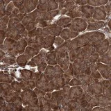 Immunohistochemistry (Formalin/PFA-fixed paraffin-embedded sections) - Anti-GRIP1 antibody (AB122514)