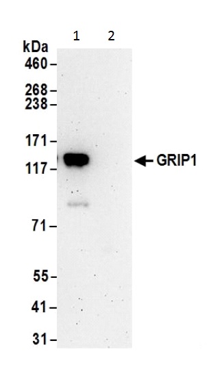 Immunoprecipitation - Anti-GRIP1 antibody (AB226201)