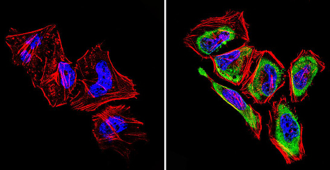 Immunocytochemistry/ Immunofluorescence - Anti-GRK1 antibody [D11] (AB2776)
