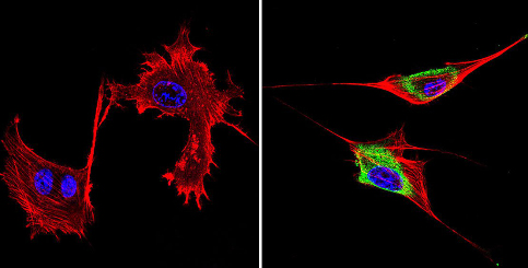 Immunocytochemistry/ Immunofluorescence - Anti-GRK1 antibody [D11] (AB2776)