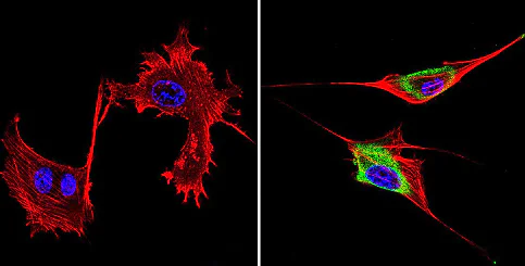 Immunocytochemistry/ Immunofluorescence - Anti-GRK1 antibody [D11] (AB2776)