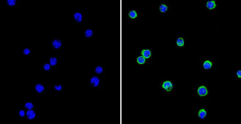 Immunocytochemistry/ Immunofluorescence - Anti-GRK1 antibody [D11] (AB2776)